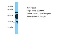 Invitrogen SULT4A1 Polyclonal Antibody 100 &mu;L; Unconjugated:Antibodies,