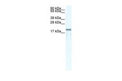 Invitrogen CXCL14 Polyclonal Antibody 100 &mu;L; Unconjugated:Antibodies,