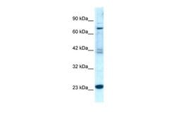Invitrogen RGS10 Polyclonal Antibody 100 &mu;L; Unconjugated:Antibodies,