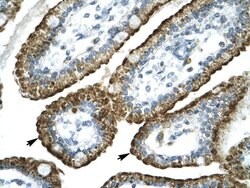 Invitrogen GABRP Polyclonal Antibody 100 &mu;L; Unconjugated:Antibodies,