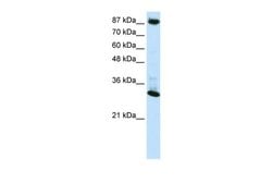 Invitrogen CTCF Polyclonal Antibody 100 &mu;L | Buy Online | Invitrogen&trade; | Fisher Scientific