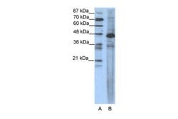 Invitrogen SRF Polyclonal Antibody 100 &mu;L | Buy Online | Invitrogen&trade; | Fisher Scientific