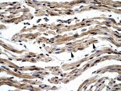 Invitrogen GTF2E1 Polyclonal Antibody 100 &mu;L; Unconjugated:Antibodies,