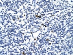 Invitrogen TAL1 Polyclonal Antibody 100 &mu;L; Unconjugated:Antibodies,