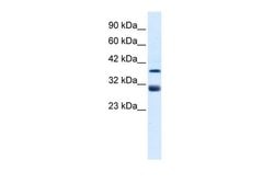 Invitrogen TAL1 Polyclonal Antibody 100 &mu;L; Unconjugated:Antibodies,