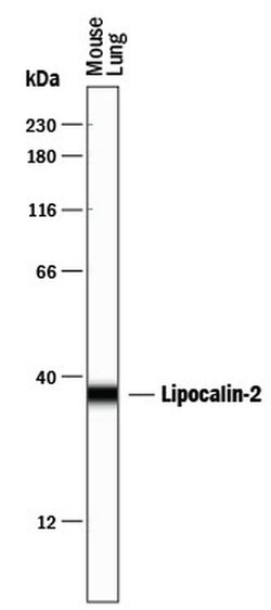 Invitrogen NGAL Polyclonal Antibody 100 &mu;g; Unconjugated:Antibodies,