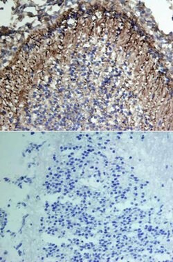 Invitrogen VCAM-1 Polyclonal Antibody 100 &mu;g; Unconjugated:Antibodies,