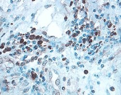 Invitrogen ULBP2/ULBP5/ULBP6 Polyclonal Antibody 100 &mu;g; Unconjugated:Antibodies,