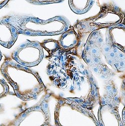 Invitrogen Renin Polyclonal Antibody 100 &mu;g; Unconjugated:Antibodies,