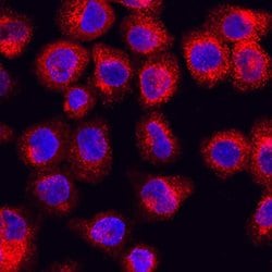 Invitrogen RAB27A Polyclonal Antibody 100 &mu;g; Unconjugated:Antibodies,