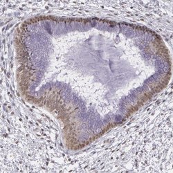 ALX1 Rabbit anti-Human, Polyclonal, Invitrogen 100 &mu;L; Unconjugated:Antibodies,