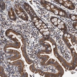 DFNB31, Polyclonal, Invitrogen 100&mu;L; Unconjugated:Antibodies, Polyclonal