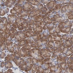 DHRSX Rabbit anti-Human, Polyclonal, Invitrogen 100 &mu;L; Unconjugated:Antibodies,