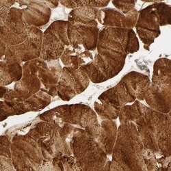 Calcium Channel 1G, Polyclonal, Invitrogen 100&mu;L; Unconjugated:Antibodies,