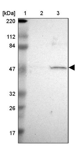 CHRNB1 Polyclonal Antibody, Invitrogen 100 &mu;L; Unconjugated:Antibodies,