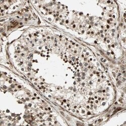 SCAND3 Polyclonal Antibody, Invitrogen 100 &mu;L; Unconjugated:Antibodies,