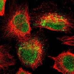ALKBH3 Polyclonal Antibody, Invitrogen 100 &mu;L; Unconjugated:Antibodies,