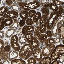 KLHL8 Rabbit anti-Human, Polyclonal, Invitrogen 100 &mu;L; Unconjugated:Antibodies,