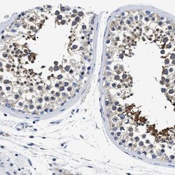 MEA1 Polyclonal Antibody, Invitrogen 100 &mu;L; Unconjugated:Antibodies,