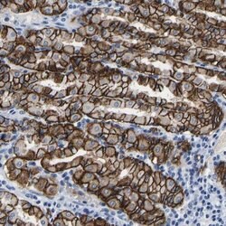 MCTP1 Polyclonal Antibody, Invitrogen 100 &mu;L; Unconjugated:Antibodies,