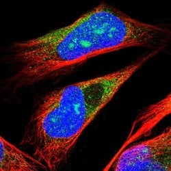 ARMC9 Rabbit anti-Human, Polyclonal, Invitrogen 100 &mu;L; Unconjugated:Antibodies,