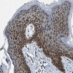 ARMC9 Rabbit anti-Human, Polyclonal, Invitrogen 100 &mu;L; Unconjugated:Antibodies,