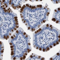 HABP2 Polyclonal Antibody, Invitrogen 100 μL; Unconjugated:Antibodies,