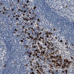 KV3.2 (KCNC2) Rabbit anti-Human, Polyclonal, Invitrogen 100 &mu;L; Unconjugated:Antibodies,