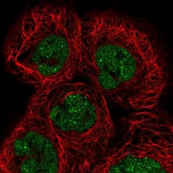 ESRP1, Polyclonal, Invitrogen 100&mu;L; Unconjugated:Antibodies, Polyclonal