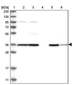 PPM1K Polyclonal Antibody, Invitrogen 100 &mu;L | Buy Online | Invitrogen | Fisher Scientific