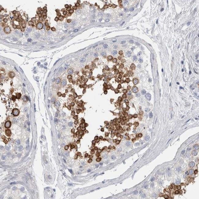 ADAM2 Polyclonal Antibody, Invitrogen 100 μL; Unconjugated:Antibodies ...