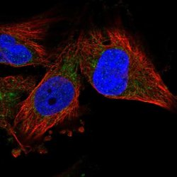 VDAC2/VDAC3, Polyclonal, Invitrogen 100μL; Unconjugated:Antibodies,