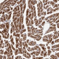 VDAC2/VDAC3, Polyclonal, Invitrogen 100μL; Unconjugated:Antibodies,