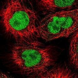 CHD1L Polyclonal Antibody, Invitrogen 100 &mu;L; Unconjugated:Antibodies