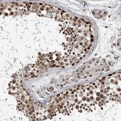 CHD1L Polyclonal Antibody, Invitrogen 100 &mu;L; Unconjugated:Antibodies
