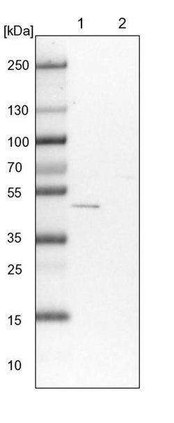 FMO2 Polyclonal Antibody, Invitrogen 100 &mu;L; Unconjugated:Anticuerpos