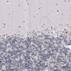 HELZ Rabbit anti-Human, Polyclonal, Invitrogen 100 &mu;L; Unconjugated:Antibodies,