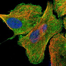 USP21 Polyclonal Antibody, Invitrogen 100 &mu;L; Unconjugated:Antibodies,