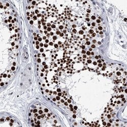 SIM2 Polyclonal Antibody, Invitrogen 100 &mu;L; Unconjugated:Antibodies,
