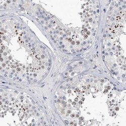 C2orf83 Rabbit anti-Human, Polyclonal, Invitrogen 100 &mu;L; Unconjugated:Antibodies,