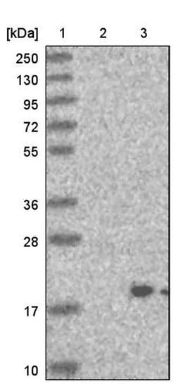 SMDT1, Polyclonal, Invitrogen 100&mu;L; Unconjugated:Antibodies, Polyclonal