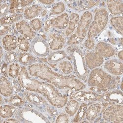 GNB1L Polyclonal Antibody, Invitrogen 100 &mu;L; Unconjugated:Antibodies,