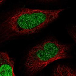Macro H2A.2, Polyclonal, Invitrogen 100&mu;L; Unconjugated:Antibodies,