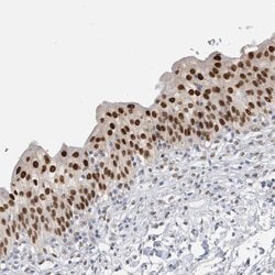 Macro H2A.2, Polyclonal, Invitrogen 100&mu;L; Unconjugated:Antibodies,