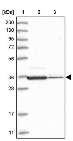 Macro H2A.2, Polyclonal, Invitrogen 100&mu;L; Unconjugated:Antibodies,