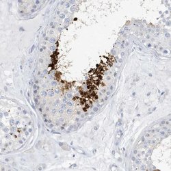 GSE1 Polyclonal Antibody, Invitrogen 100 &mu;L; Unconjugated:Antibodies,