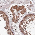 PPP1R21 Polyclonal Antibody, Invitrogen™