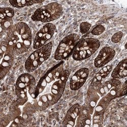 VWA2 Polyclonal Antibody, Invitrogen 100 &mu;L; Unconjugated:Antibodies,