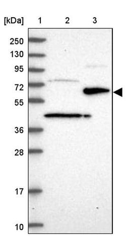 ST7 Polyclonal Antibody, Invitrogen 100 &mu;L; Unconjugated:Antibodies,