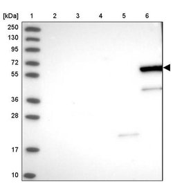 ZNF45 Rabbit anti-Human, Polyclonal, Invitrogen 100 &mu;L; Unconjugated:Antibodies,